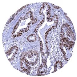 Genetex Inc&nbsp;MSH6 Monoclonal Antibody [MSVA-906R] HistoMAX™ (GTX04416) GeneTex - IHC-Optimized Antibody.