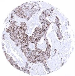 Genetex Inc TdT Monoclonal Antibody [MSVA-453R] HistoMAX™ (GTX04417) GeneTex - IHC-Optimized Antibody.
