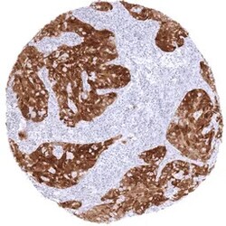 Genetex Inc&nbsp;CDKN2A / p16INK4a Monoclonal Antibody [MSVA-016R] HistoMAX™ (GTX04442) GeneTex - IHC-Optimized Antibody.