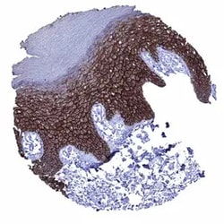 Genetex Inc&nbsp;Desmoglein 1 Monoclonal Antibody [MSVA-544M] HistoMAX™ (GTX04464) GeneTex - IHC-Optimized Antibody.