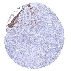 Genetex Inc&nbsp;Desmoglein 3 Monoclonal Antibody [MSVA-543M] HistoMAX™ (GTX04468) GeneTex - IHC-Optimized Antibody.
