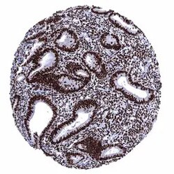 Genetex Inc Estrogen Receptor alpha Monoclonal Antibody [MSVA-564R] HistoMAX™ (GTX04474) GeneTex - IHC-Optimized Antibody.