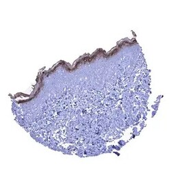 Genetex Inc&nbsp;Kallikrein 7 Monoclonal Antibody [MSVA-707M] HistoMAX™ (GTX04475) GeneTex - IHC-Optimized Antibody.