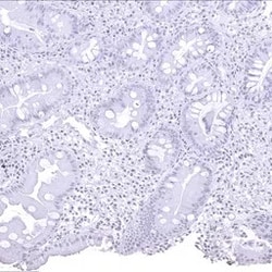 Genetex Inc&nbsp;Helicobacter pylori Catalase Monoclonal Antibody [MSVA-466M] HistoMAX™ (GTX04479) GeneTex - IHC-Optimized Antibody.