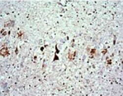 BIORBYT LLC&nbsp;Phospho-Tauthr217RabbitPolyclo