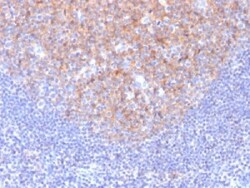 BIORBYT LLC&nbsp;CD81Antibody