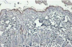 BIORBYT LLC&nbsp;Filaggrinantibody
