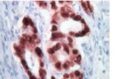 Abcam&nbsp;Rabbit specific HRP/DAB Detection IHC Kit