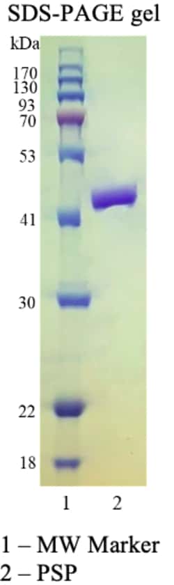 AURORA BIOLABS LLC&nbsp;PreScission Protease (HRV 3C), 1000 units