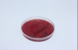 Oxyrase OxyPRAS StrictAna Blood Agar Plate