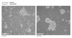 ATCC CHLA-05-ATRT (CRL-3037) Human atypical teratoid rhabdoid tumor cell line
