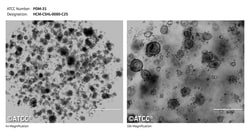 ATCC&nbsp;PDM-31 Pancreatic Tumor Organoid Model (HCM-CSHL-0080-C25)