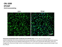ATCC&nbsp;hTERT EP156T (CRL-3289) Human Prostate Epithelial Cell Line, hTERT-immortalized