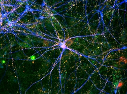 Brainxell Inc&nbsp;BrainFast D4 Supplement (1mL)