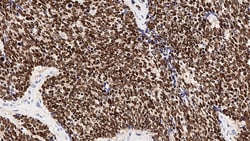 Leica Biosystems&nbsp;Thyroid Transcription Factor-1 (TTF-1) antibody, clone SPT24 - liquid concentrate and BOND RTU formats