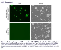 ATCC Raji-GFP-Luc2 (CCL-86-GFP-LUC2) Frozen Reporter Cell Line, Dual GFP and Luciferase (luc2), BSL 2, CD19 positive
