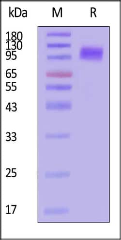 ACROBiosystems HUMAN APP PROTEIN HIS 500UG, Quantity: Each of 1