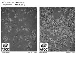 Hs 936.T(C1) cells (ATCC CRL-7687) - human melanoma skin epithelial adherent cell line