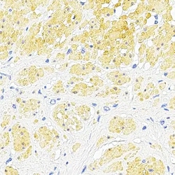 Leica Biosystems HRP Yellow Chromogen (DC9462), Ready-to-Use, 50 tests