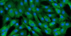 Cloud Clone Corp&nbsp;CSI008Ca01 Cloud-Clone Brand Primary Canine Annulus Fibrosus Cells (AFC) Size 5X10^5 Ship with dry ice
