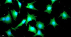 Cloud Clone Corp&nbsp;CSI008Ra01 Cloud-Clone Brand Primary Rat Annulus Fibrosus Cells (AFC) Size 5X10^5 Ship with dry ice