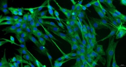 Cloud Clone Corp&nbsp;CSI034Ra01 Cloud-Clone Brand Primary Rat Pulmonary Fibroblasts (PF) Size 5X10^5 Ship with dry ice