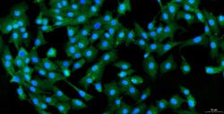 Cloud Clone Corp&nbsp;CSI113Ra01 Cloud-Clone Brand Primary Rat Nucleus Pulposus Cells (NPC) Size 5X10^5 Ship with dry ice