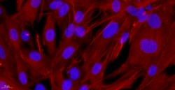 Cloud Clone Corp&nbsp;CSI138Ra01 Cloud-Clone Brand Primary Rat Ovarian Fibroblasts (OF) Size 5X10^5 Ship with dry ice