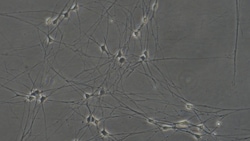 Cloud Clone Corp&nbsp;CSI238Ra01 Cloud-Clone Brand Primary Rat Trigeminal ganglion neuron cells (TGN) Size 5X10^5 Ship with dry ice