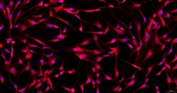 Cloud Clone Corp&nbsp;CSI249Ra01 Cloud-Clone Brand Primary Rat Tendon Cells (TC) Size 5X10^5 Ship with dry ice