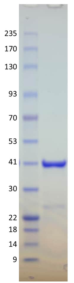 AURORA BIOLABS LLC&nbsp;Kras Q61K, GST-tag, GppNHp loaded,100