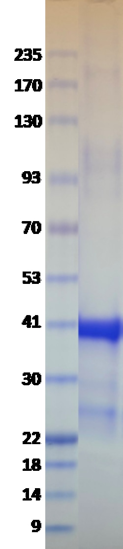 AURORA BIOLABS LLC&nbsp;Kras Q61R, GST-tag,100