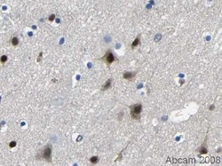 anti-TBR1, Polyclonal, Abcam 100&mu;g, Unlabeled:Antibodies, Polyclonal