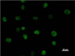 Abcam Mouse monoclonal [SATBA4B10] to SATB2 - C-terminal, Quantity: Each