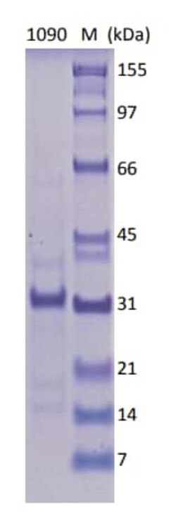 Abcam Recombinant Human Androgen Receptor protein (His tag), 10UG, Quantity: