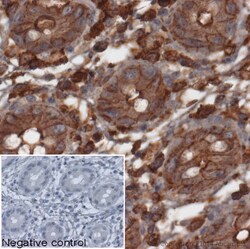 Abcam Rabbit polyclonal to beta Actin, Quantity: Each of 1