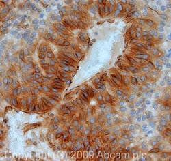 Abcam Rabbit polyclonal to beta Tubulin - Loading Control, Quantity: Each