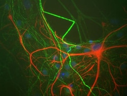 anti-GFAP, Clone: 2A5, Abcam 100 &mu;L | Buy Online | Abcam | Fisher Scientific