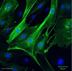 anti-alpha smooth muscle Actin, Clone: 1A4, Abcam 500&mu;L, Unlabeled:Antibodies,