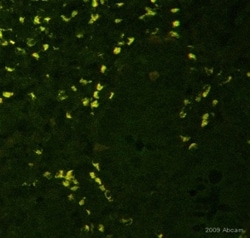 Abcam Mouse monoclonal [236A/E7] to FOXP3, Quantity: Each of 1