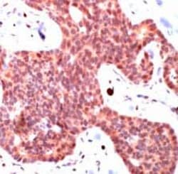 Abcam Rabbit polyclonal to Smad3, Quantity: Each of 1