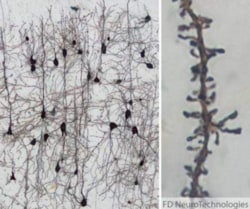 Fd Neurotechnologies Inc&nbsp;FD RAPID GOLGISTAIN KIT SMALL
