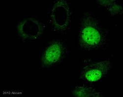 Abcam Rabbit polyclonal to Histone H3 (tri methyl K36) - ChIP Grade, Quantity: