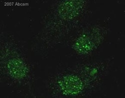 Abcam Rabbit polyclonal to gamma H2A.X (phospho S139), Quantity: Each of
