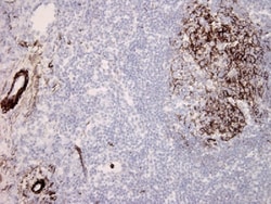 Abcam Mouse monoclonal [aE11] to C5b-9 + C5b-8, Quantity: Each of 1