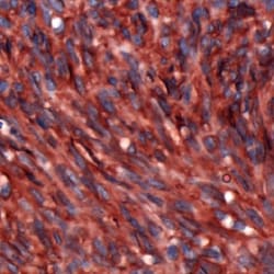 Abcam Rabbit polyclonal to TMEM16A, Quantity: Each of 1