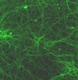 Abcam Mouse monoclonal [TU-20] to beta III Tubulin - Neuronal Marker, Quantity: