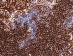 Abcam Rabbit polyclonal to CD3, Quantity: Each of 1