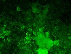 Lonza Walkersville OsteoImage Mineralization Assay, 500 Test, Quantity: