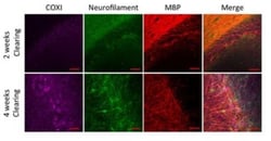Abcam Mouse monoclonal [1D6E1A8] to MTCO1, Quantity: Each of 1